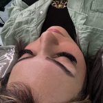 کاشت مژه